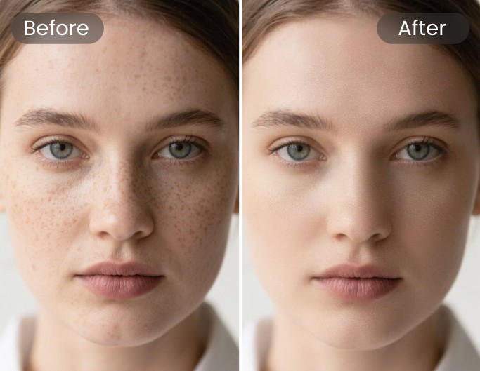 Spot Removal