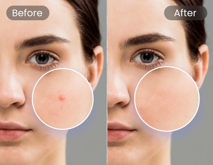 Use clone stamp tool to remove a blemish from a girl photo