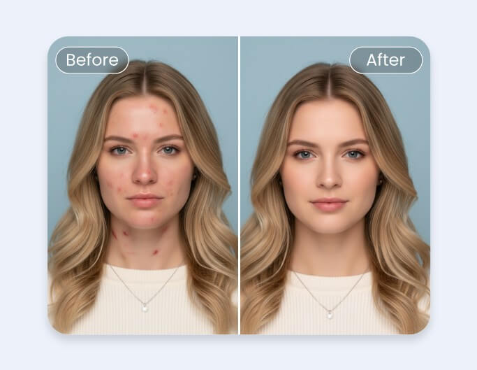Fotorの自撮り加工サイトで女性の顔の気になる部分を補正する