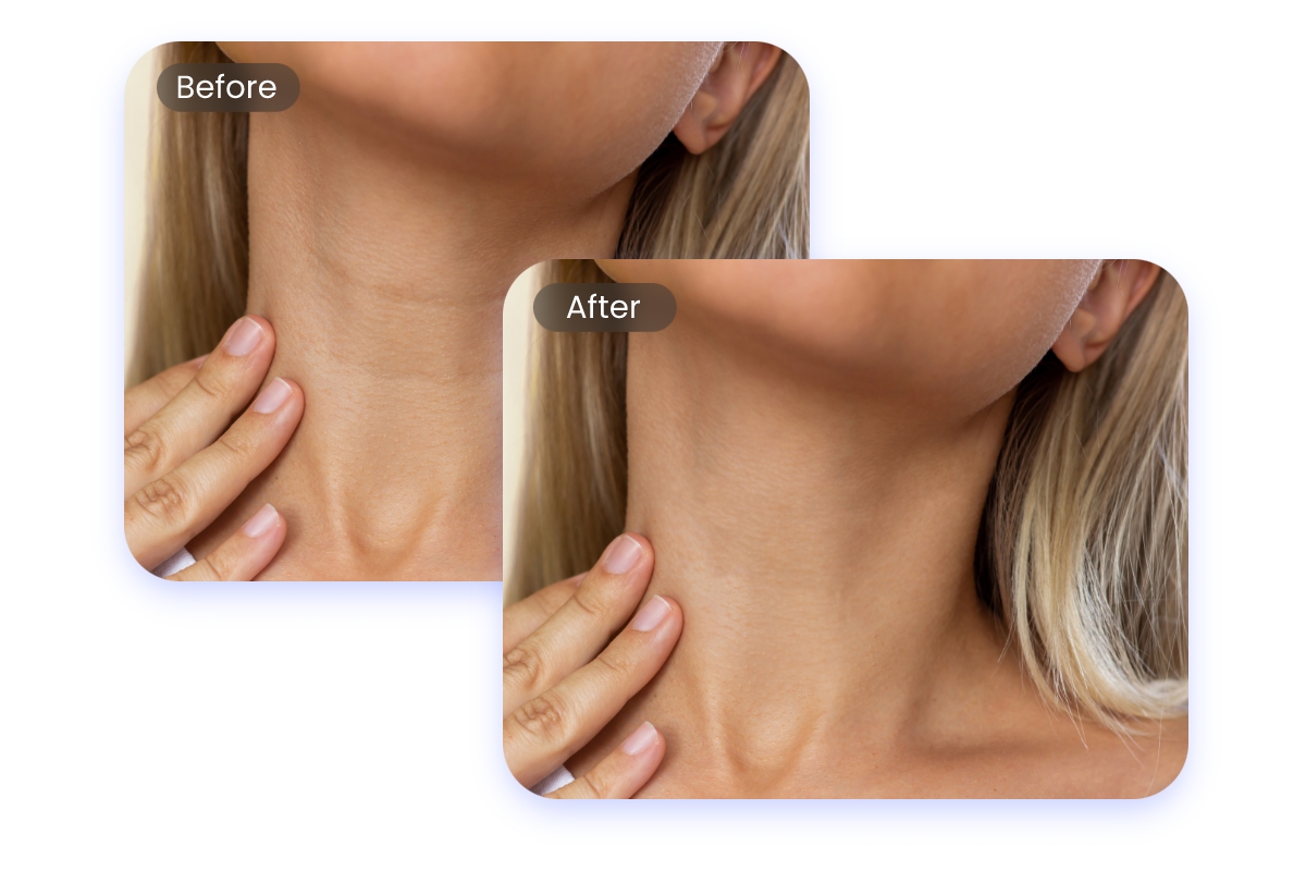 Before and after comparison showing that removing neck wrinkles in a photo