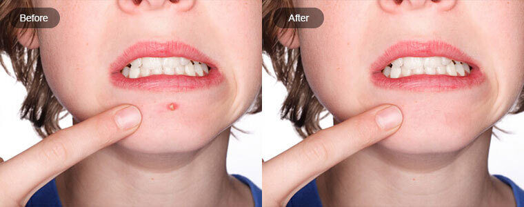 Sideimage photo retouching 2
