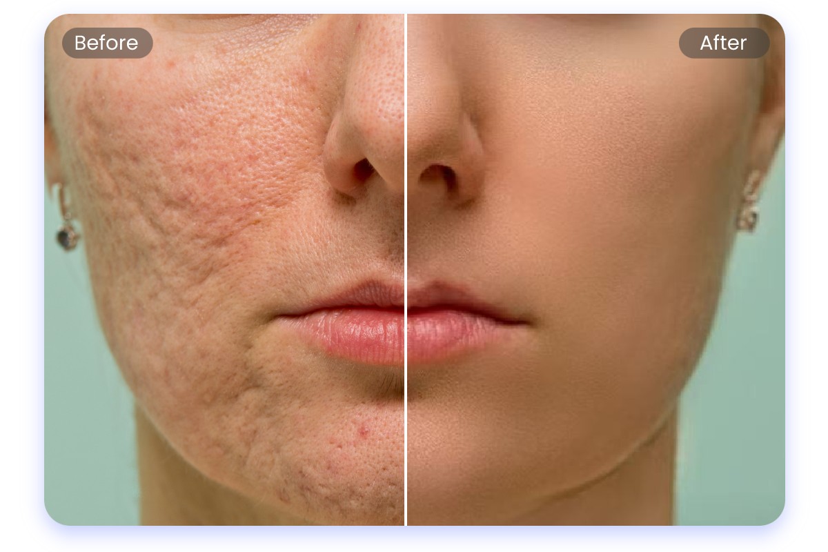 Smoothing skin naturally with AI face editing tools